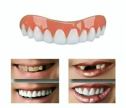 طقم تجميل الأسنان العلوية